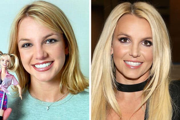 10 Stars Who Have Had Rhinoplasty Success