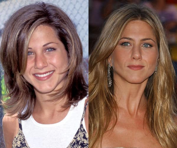 10 Stars Who Have Had Rhinoplasty Success