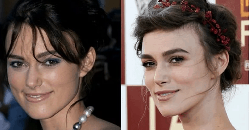 10 Stars Who Have Had Rhinoplasty Success