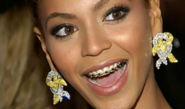 10 stars who were forced to wear braces