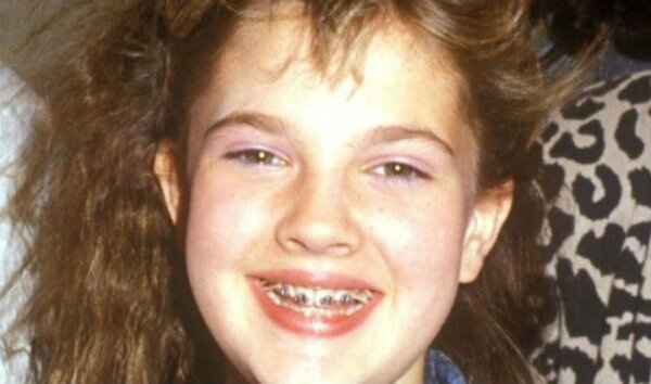 10 stars who were forced to wear braces