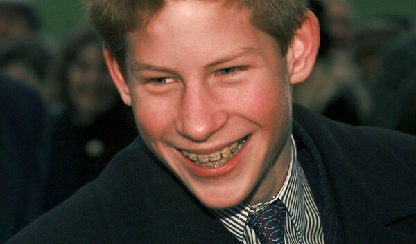 10 stars who were forced to wear braces