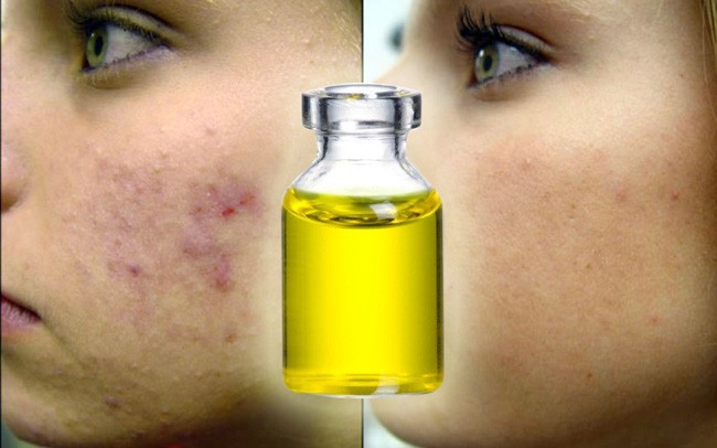 10 Unusual Uses for Castor Oil