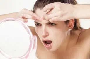 Acne is always making your life miserable? Try some home remedies to get rid of embarrassing pimples.