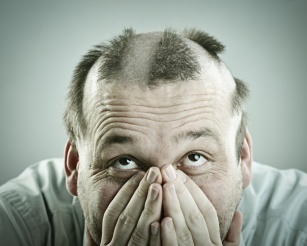 Androgenetic alopecia &#8211; what drugs are effective for hair loss in men?