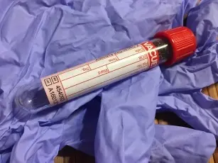 Blood test - how often to do?