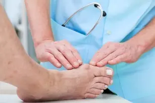 Bunions &#8211; treatment of this unpleasant ailment. How to treat yourself at home, what to buy at the pharmacy?