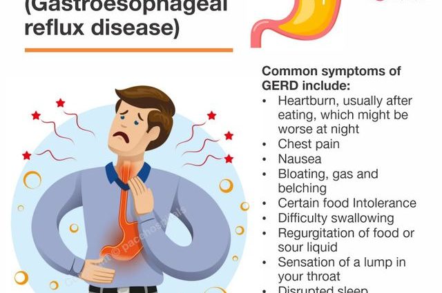 Esophageal reflux &#8211; what are the causes and symptoms of gastroesophageal reflux disease?