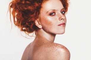 Freckles &#8211; do they disfigure or beautify? Check how to remove them and how to care for them!