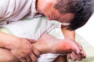 Gout, arthritis, gout &#8211; causes, symptoms and treatments