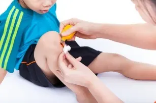 How to dress skin wounds in a child? How to heal a wound?