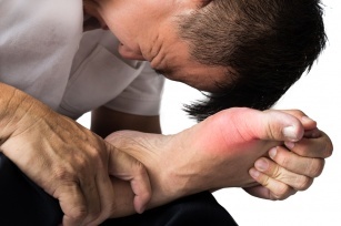 It used to be called the disease of the rich. How to recognize gout