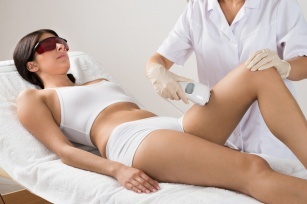 Laser hair removal for brunettes and brunettes. The best technique to fight excessive hair!