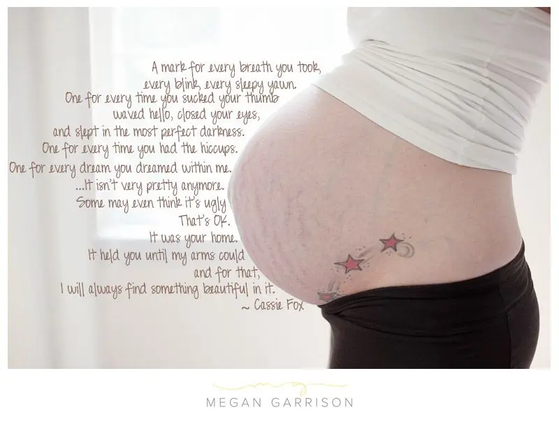 Pregnancy without stretch marks &#8211; the dream of future mothers