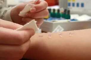 Prick tests with inhalant allergens