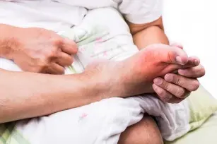 Symptoms of gout. Who does it affect most often?