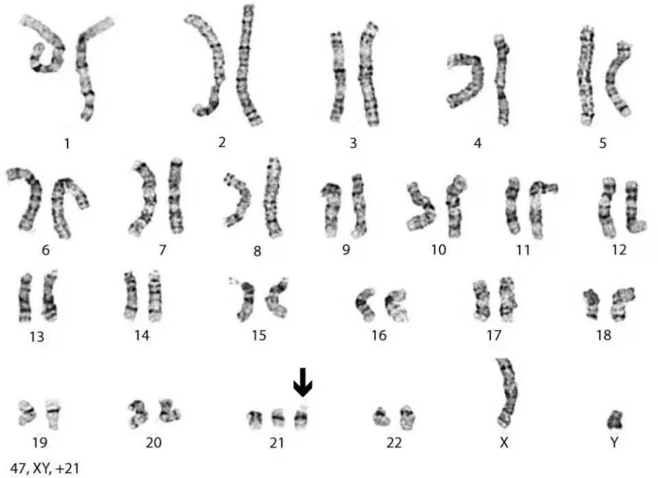 Top 10 most interesting facts about genetics