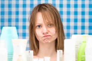 Troublesome blackheads, pustules and pimples. Check what to avoid with acne