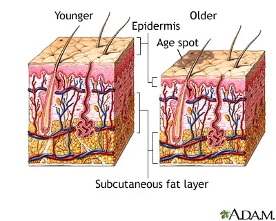 Age-related skin changes