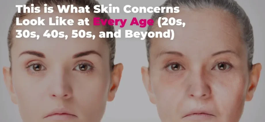 Before it&#8217;s too late: skin care after 35 years