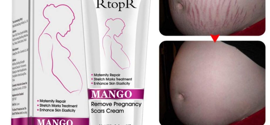 Cream for stretch marks