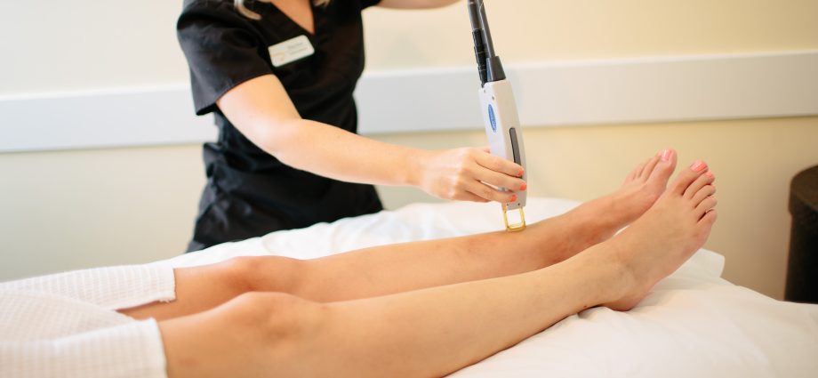 Delicate question: laser hair removal