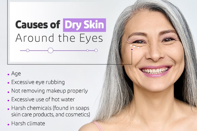 Dry skin around the eyes: what to do and what not to do