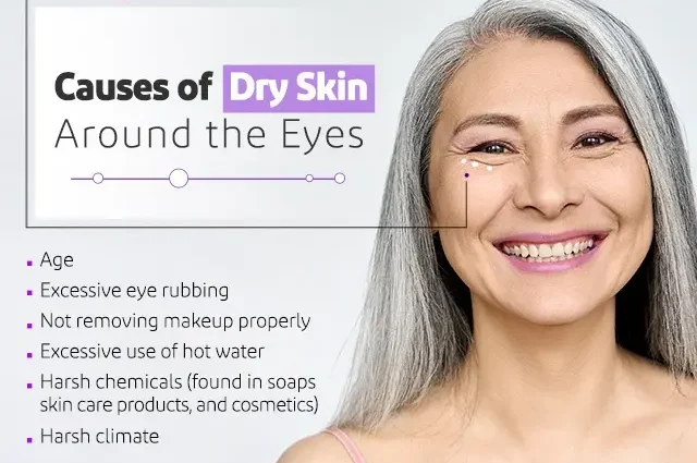 Dry skin around the eyes: what to do and what not to do