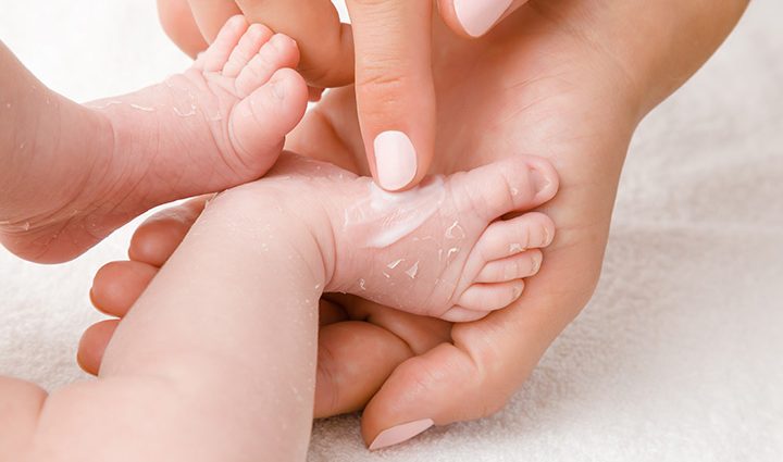 Dry skin in a newborn