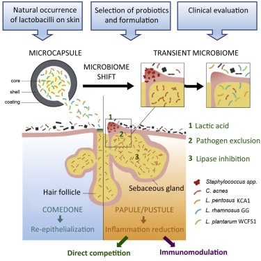 EXPERT OPINION. Problem skin microbiome