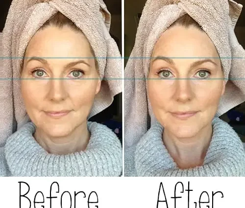 Face lifting at home