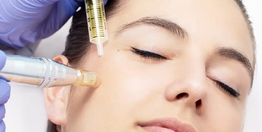 Facial skin mesotherapy