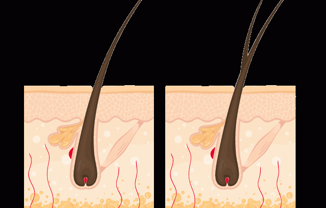 Hair to hair: split ends