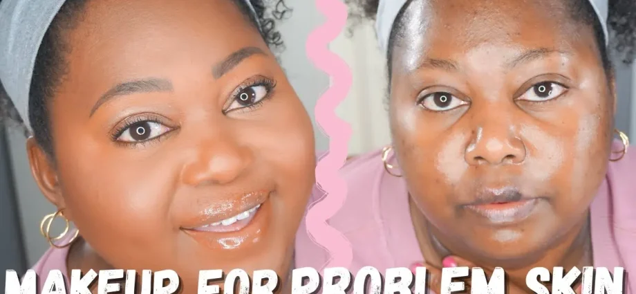 How to apply makeup on problem skin