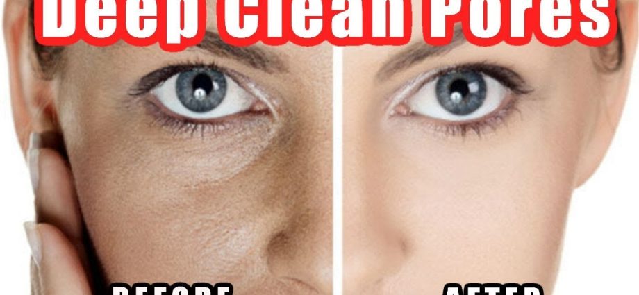 How to clear the pores on the nose