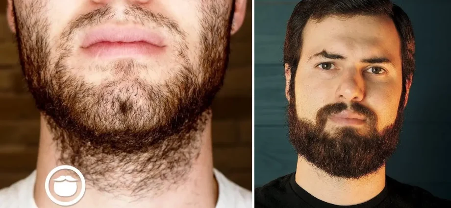 How to grow a beard