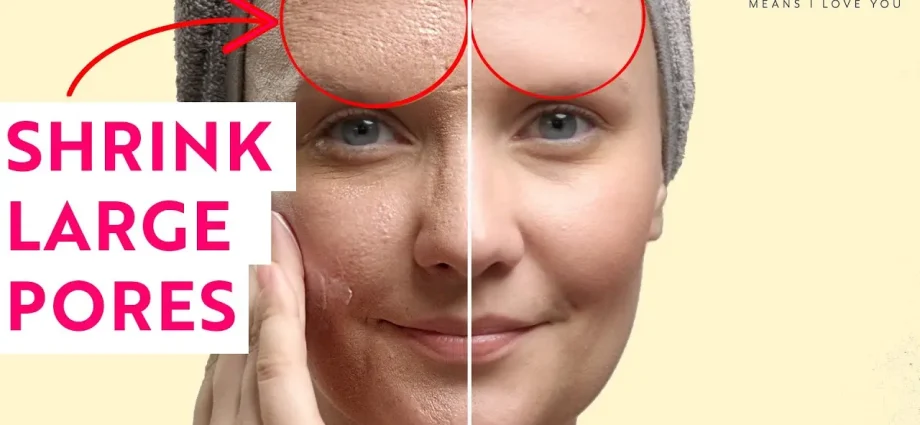 How to narrow pores?