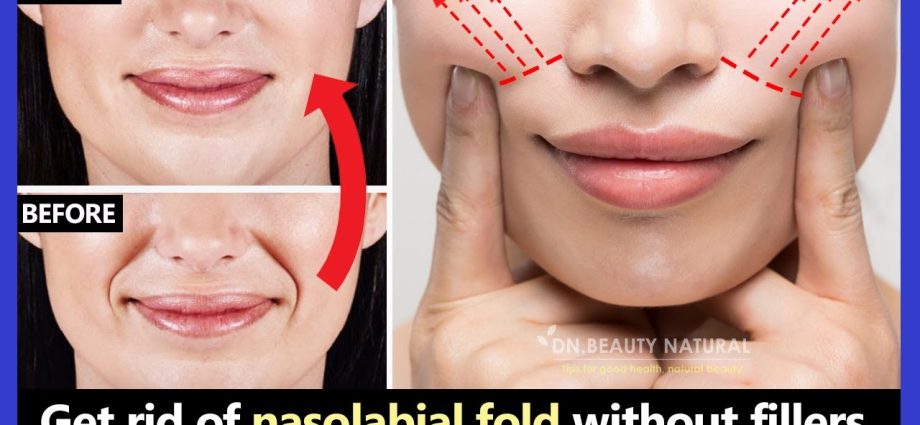 How to remove nasolabial folds