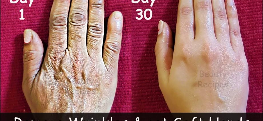 How to remove wrinkles on the hands