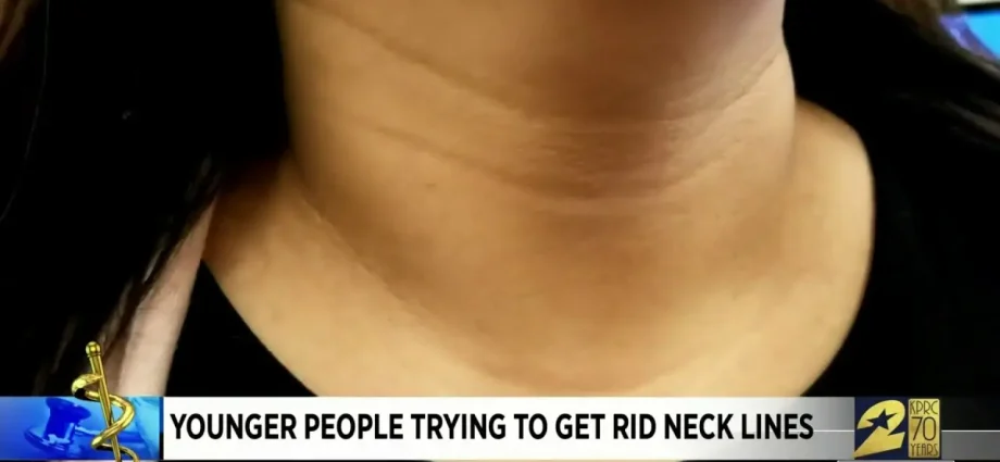 How to remove wrinkles on the neck