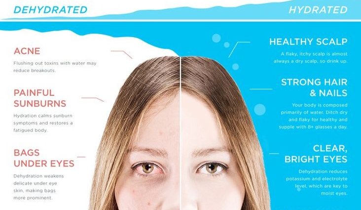 How water affects the skin