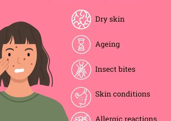 Itchy face: what to do with itchy skin