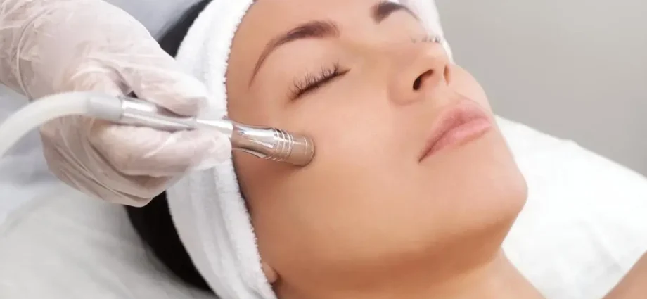 Microdermabrasion