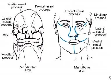 Nasolacrimal groove