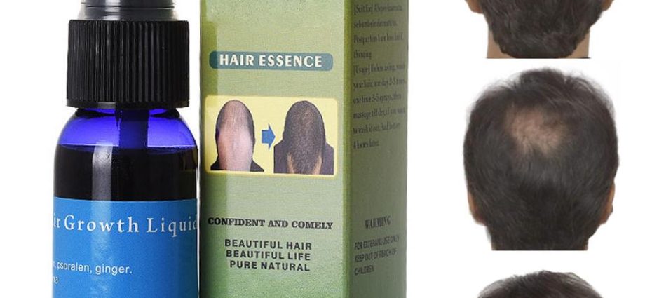 Stop Loss: Hair Loss Spray