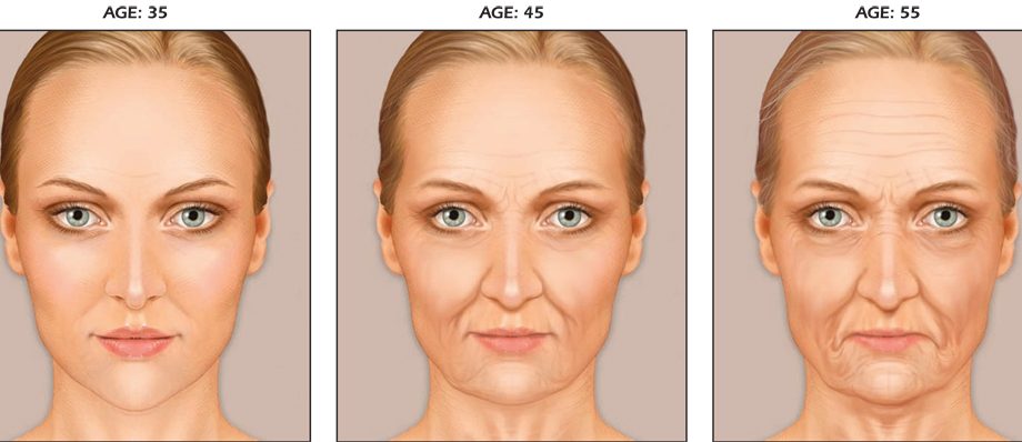 Types of Facial Aging