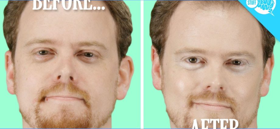 Video: why do bags under the eyes appear?