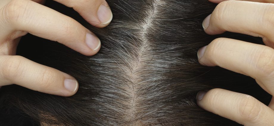 Why does hair turn gray?