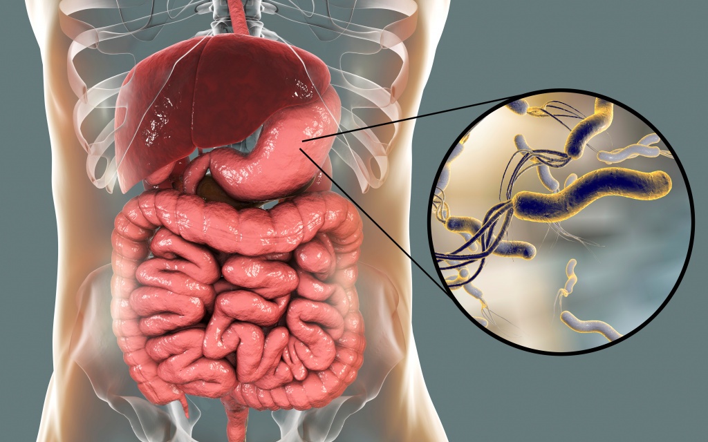 Helicobacteriosis.jpg