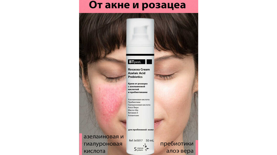 Rosacea Cream with Azelaic Acid and Prebiotics BTpeel
